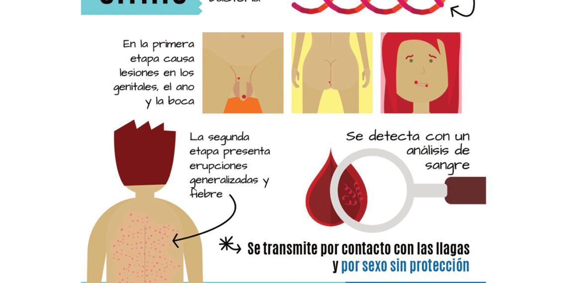 Sífilis (Ministerio de Salud).