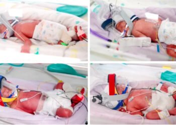 El asombroso caso de las cuatrillizas idénticas: un milagro de 1 en 15 millones en Australia (Metro North Health).